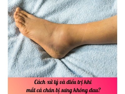 Cách xử lý và điều trị khi mắt cá chân bị sưng không đau? 