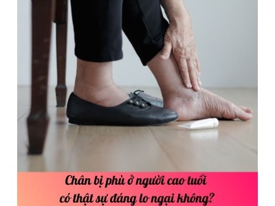 Chân bị phù ở người cao tuổi có thật sự đáng lo ngại không?