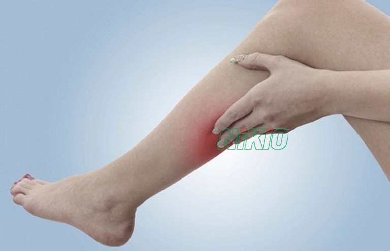 Bị bầm tím đỏ và viêm sưng ở bắp chân là biểu hiện của căng cơ bắp chân