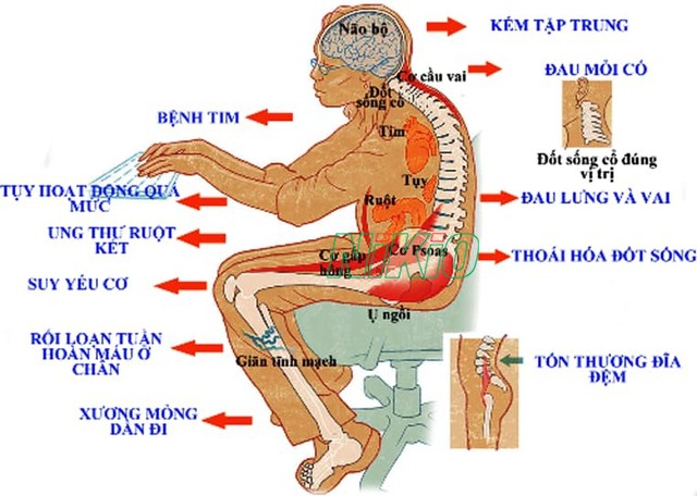 Ngồi nhiều đau mông cần thay đổi thói quen và thả lỏng người